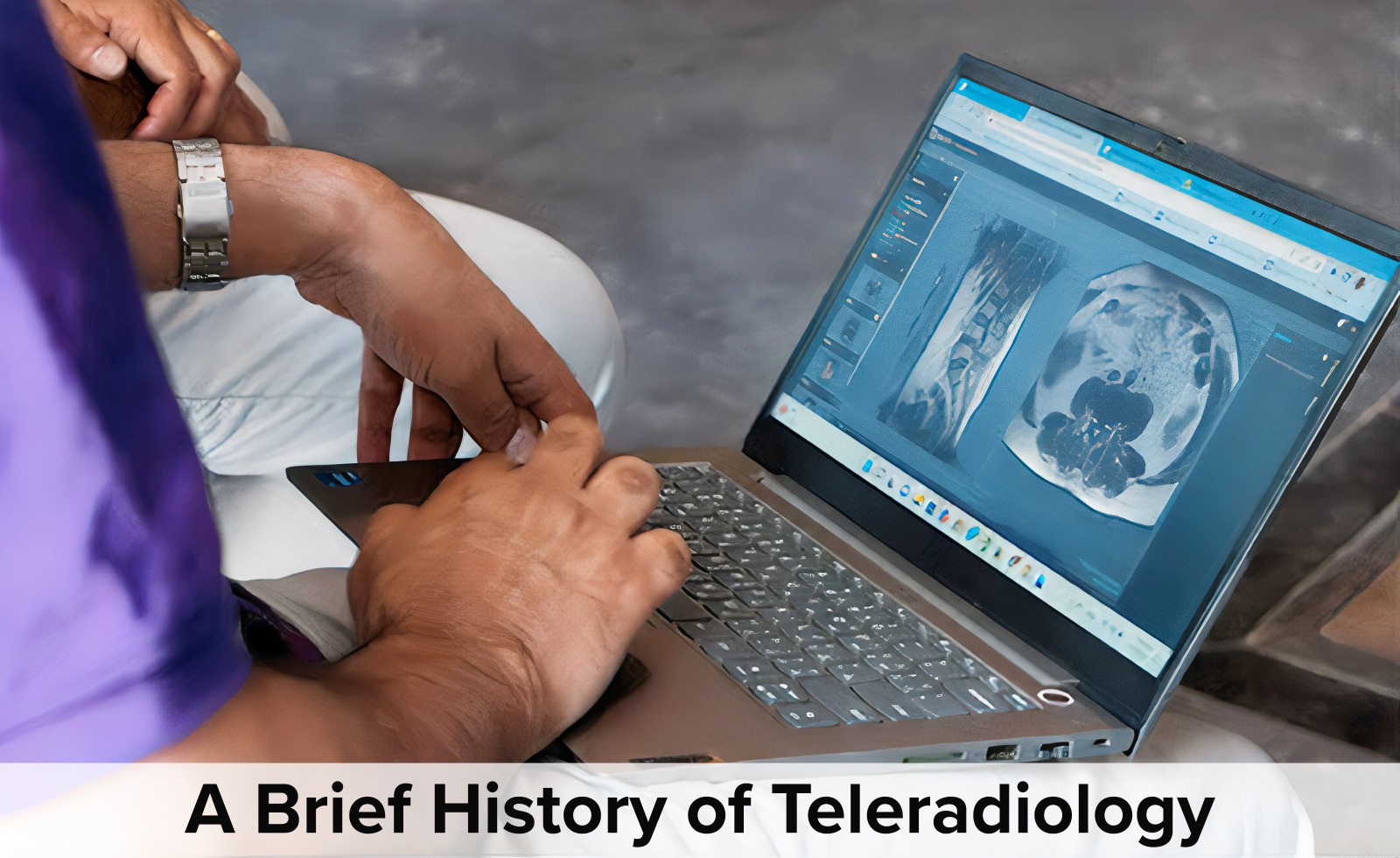 History of Teleradiology